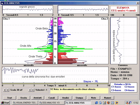 Biofeedback 2 - Centro Terapie Osteopatiche Biofeedback 2 - Centro Terapie Osteopatiche