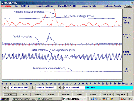 Biofeedback 3 - Centro Terapie Osteopatiche Biofeedback 3 - Centro Terapie Osteopatiche