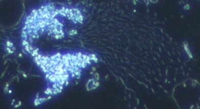 Microscopio Campo Oscuro - Centro Terapie Osteopatiche Microscopio Campo Oscuro - Centro Terapie Osteopatiche