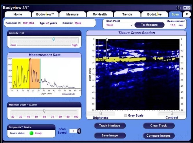 Biofeedback 4 - Centro Terapie Osteopatiche Biofeedback 4 - Centro Terapie Osteopatiche