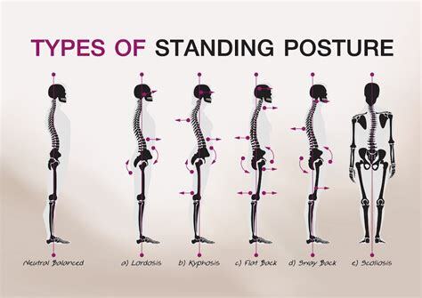 Postura - Centro Terapie Osteopatiche